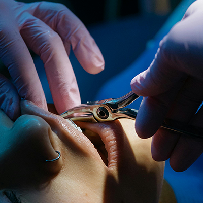 cirurgia oral cirurgia oral